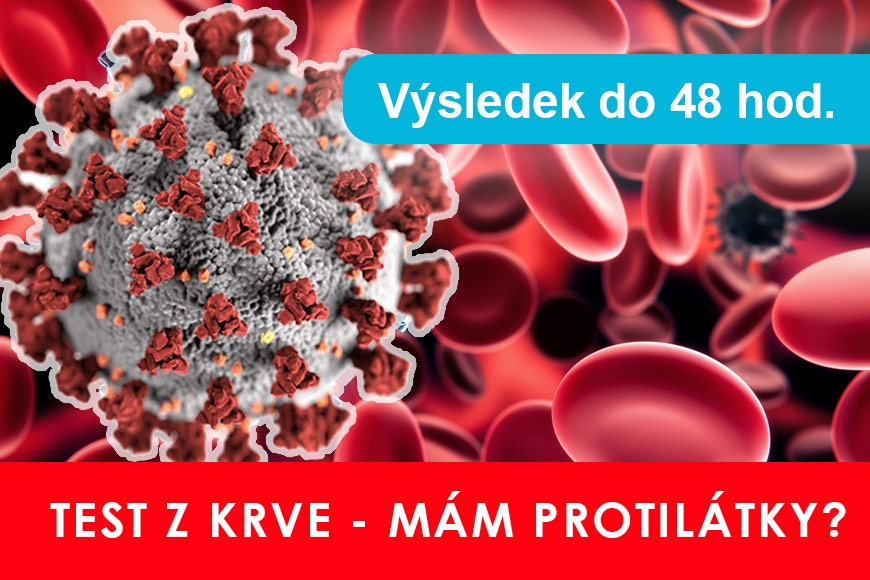 Protilátky na COVID-19 