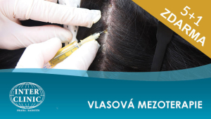 AKCE: vlasová mezoterapie 5+1 zdarma